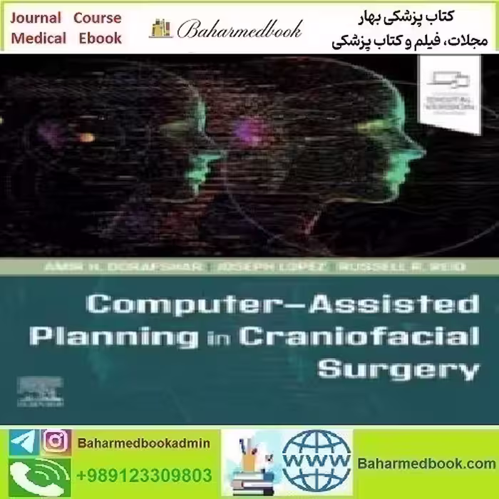 Computer Assisted Planning in Craniofacial Surgery 2024 TRUE