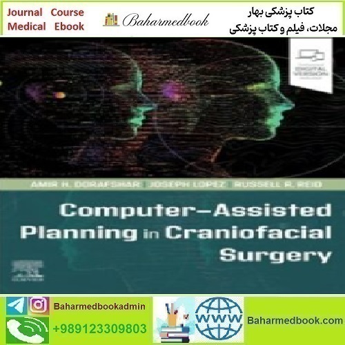 Computer Assisted Planning in Craniofacial Surgery 2024 TRUE