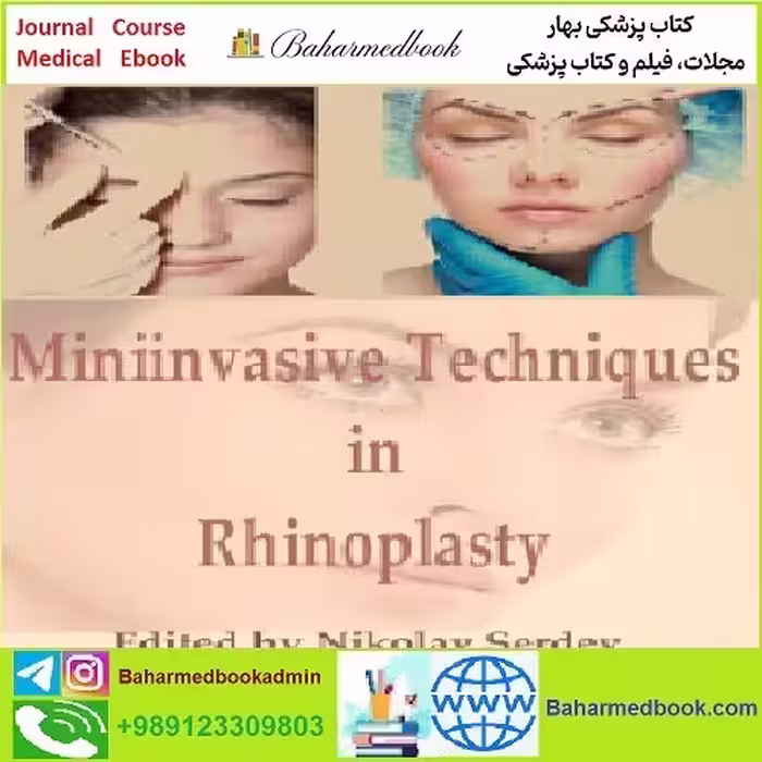 Miniinvasive Techniques in Rhinoplasty TRUE PDF price 1€ - کتاب پزشکی بهار