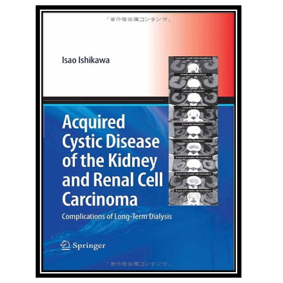 کتاب Acquired Cystic Disease of the Kidney and Renal Cell Carcinoma اثر Isao Ishikawa انتشارات مؤلفین طلایی