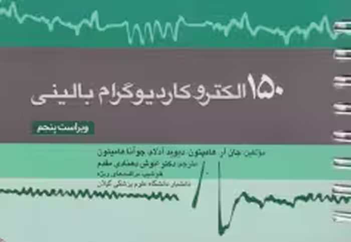 150 الکتروکاردیوگرام بالینی