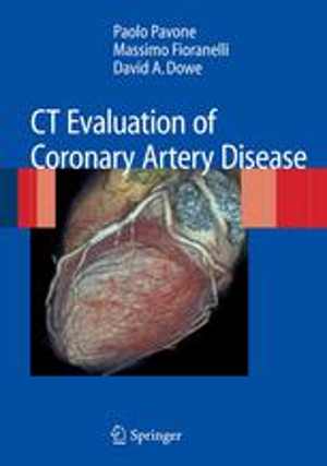 [PDF] دانلود کتاب Ct Evaluation Of Coronary Artery Disease, 2009
