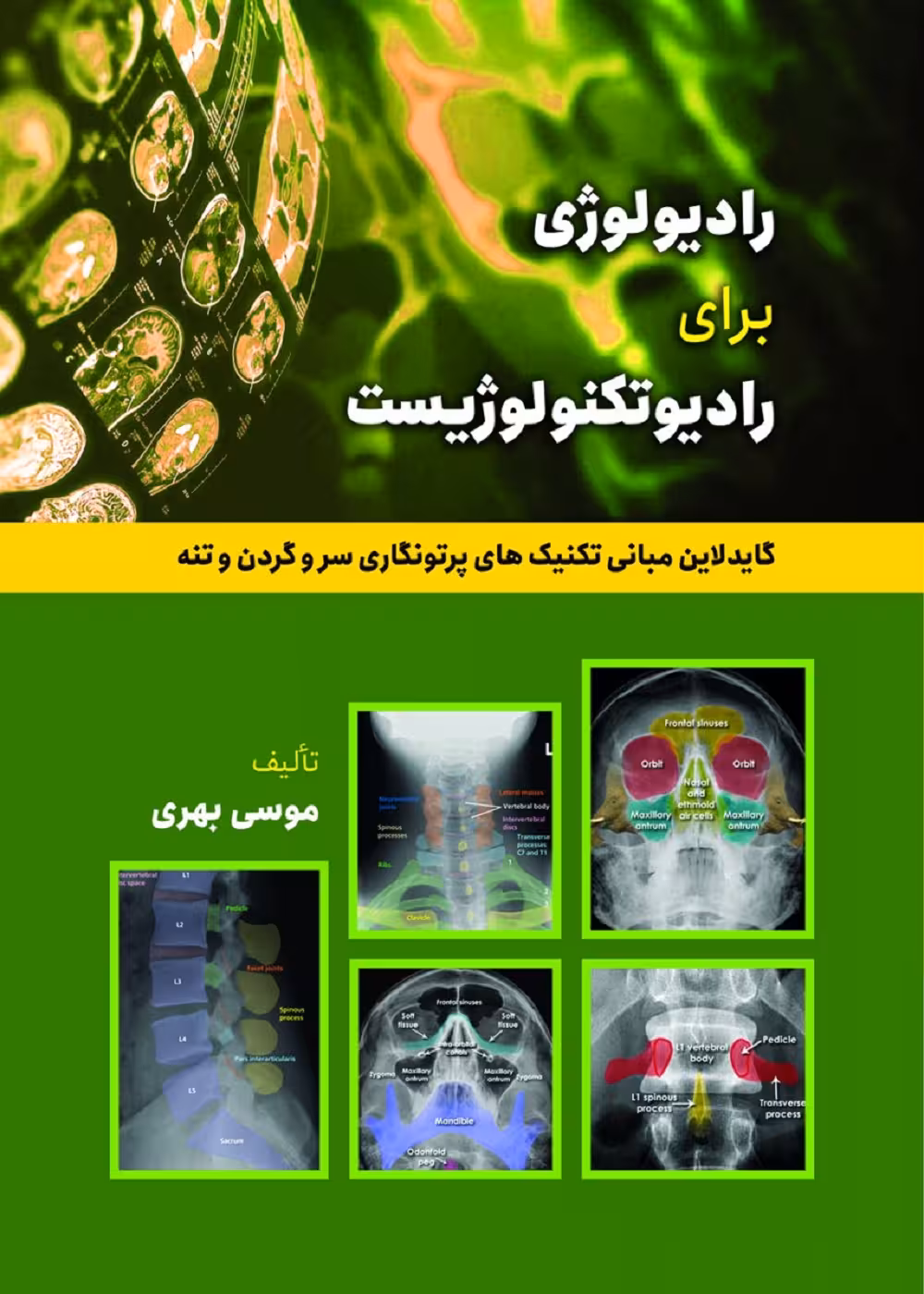 رادیولوژی برای رادیوتکنولوژیست (گایدلاین تکنیک های پرتونگاری استخوان های سر و گردن و تنه)