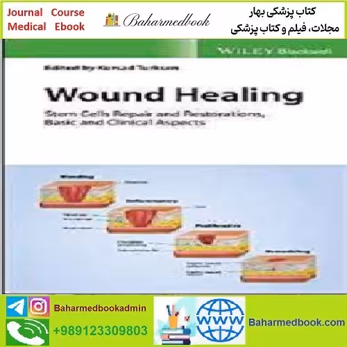 Wound Healing Stem Cells Repair and Restorations Basic and Cli
