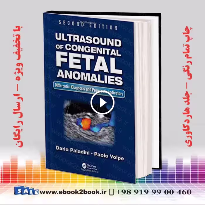 Ultrasound of Congenital Fetal Anomalies 2nd Edition