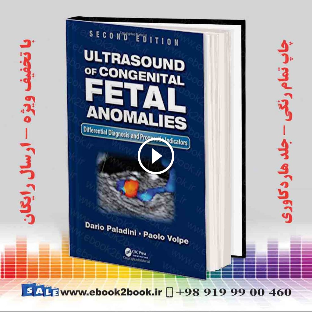 Ultrasound of Congenital Fetal Anomalies 2nd Edition