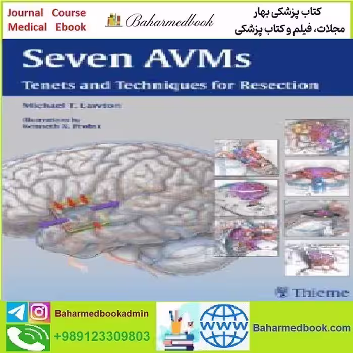 Seven AVMs Tenets and Techniques for Resection TRUE PDF pric