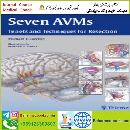 Seven AVMs Tenets and Techniques for Resection TRUE PDF pric