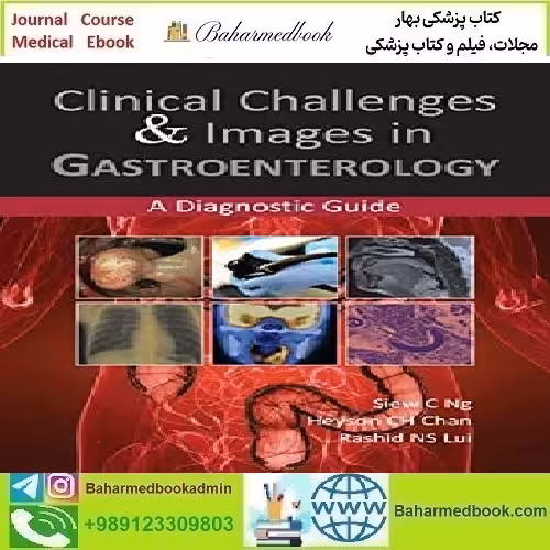 Clinical Challenges &amp; Images in Gastroenterology A Diagnostic