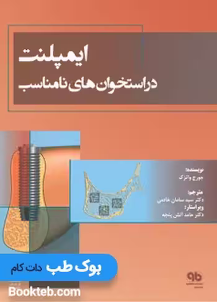 ایمپلنت در استخوان های نامناسب