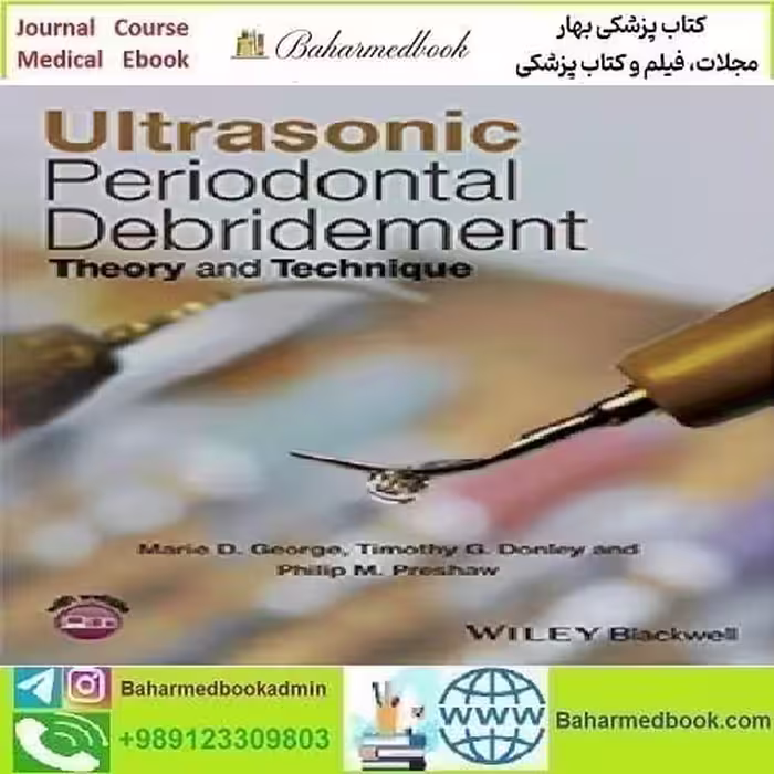 Ultrasonic Periodontal Debridement Theory and