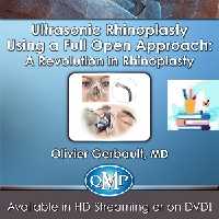 Ultrasonic Rhinoplasty Using a Full Open Approach A Revolution in Rhinoplasty at 50€ - کتاب پزشکی بهار