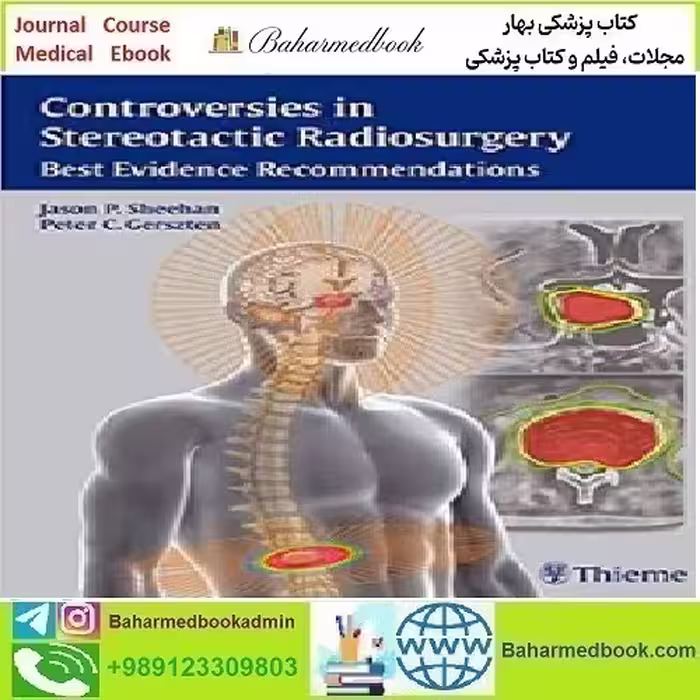 Controversies in Stereotactic Radiosurgery Best Evidenc