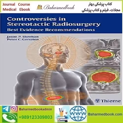 Controversies in Stereotactic Radiosurgery Best Evidenc