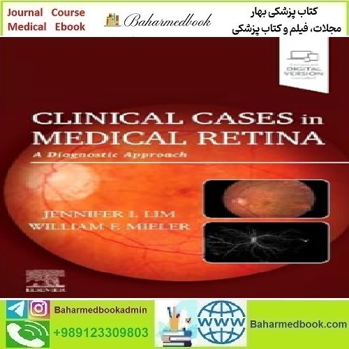 Clinical Cases in Medical Retina A Diagnostic Approach 202