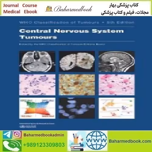 Central Nervous System Tumours WHO Classification of Tumour