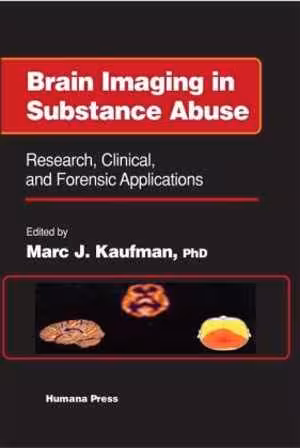 [PDF] دانلود کتاب Brain Imaging In Substance Abuse. Research, Clinical And Forensic Applns, 2001