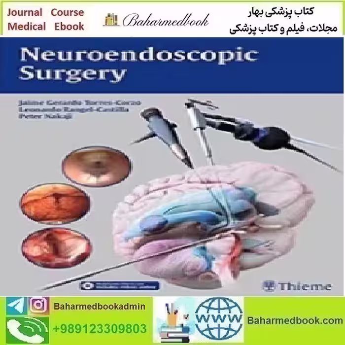Neuroendoscopic Surgery 2016 TRUE PDF price 1€ - کتاب پزشکی بهار