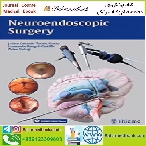 Neuroendoscopic Surgery 2016 TRUE PDF price 1€ - کتاب پزشکی بهار