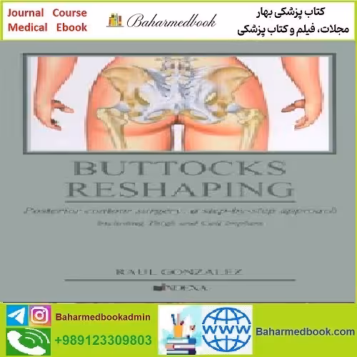 Buttocks Reshaping TRUE PDF price 1€ - کتاب پزشکی بهار