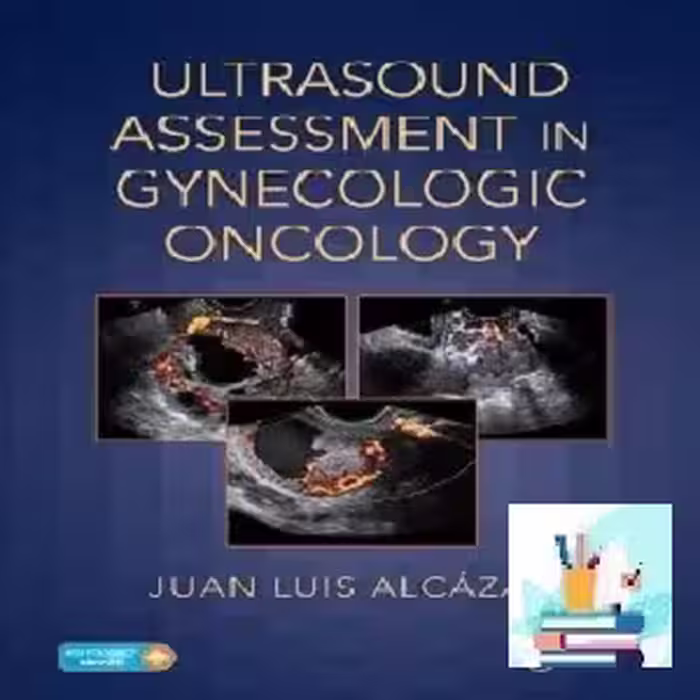 Ultrasound Assessment in Gynecologic Oncology TRUE PDF price