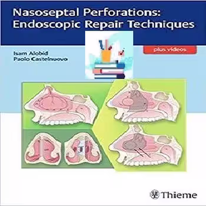Nasoseptal Perforations Endoscopic Repair Techniques 1ed PDF Video at 5€ - کتاب پزشکی بهار