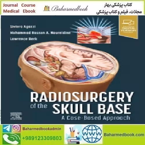 Radiosurgery of the Skull Base A Case Based Appr