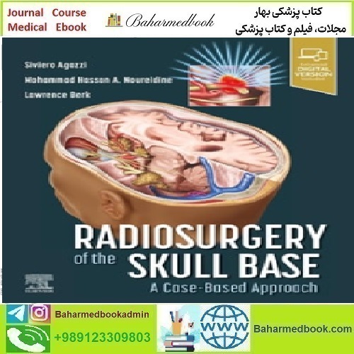 Radiosurgery of the Skull Base A Case Based Appr
