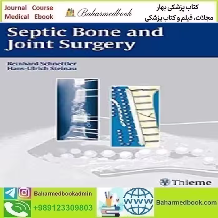 Septic Bone and Joint Surgery 2010 TRUE PDF price 1€ - کتاب پزشکی بهار