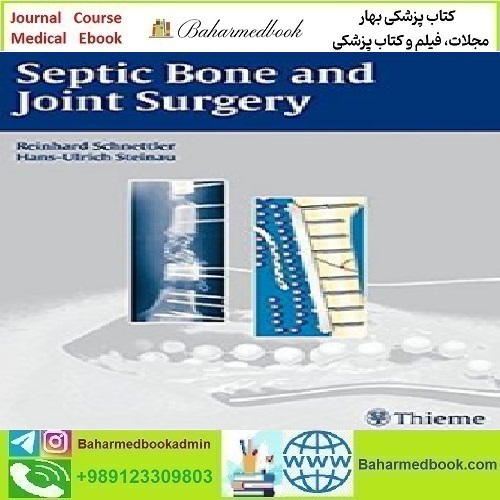Septic Bone and Joint Surgery 2010 TRUE PDF price 1€ - کتاب پزشکی بهار