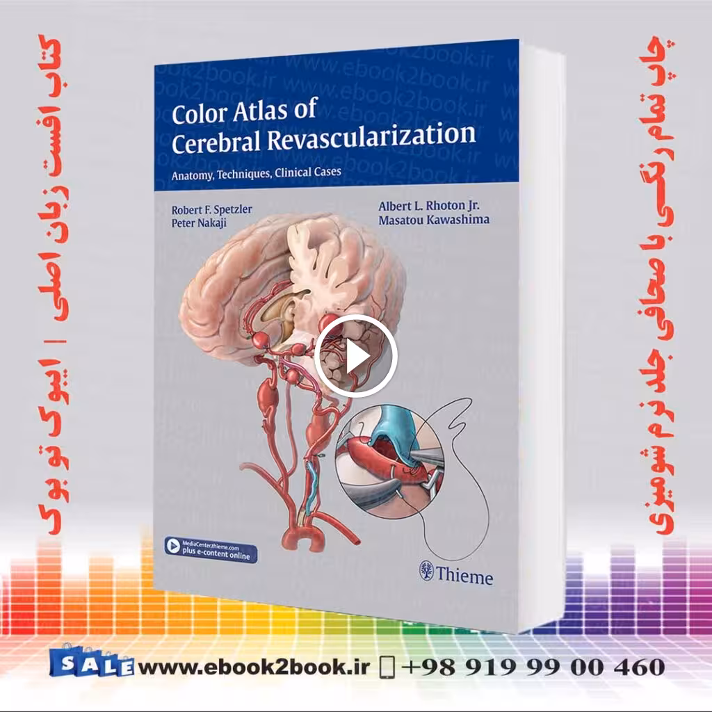 Color Atlas of Cerebral Revascularization