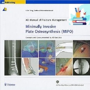 Minimally Invasive Plate Osteosynthesis (MIPO) 1ed PDF VIDEO at 1€ - کتاب پزشکی بهار