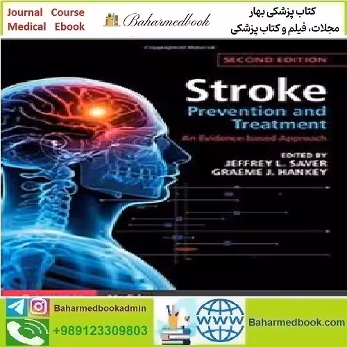 Stroke Prevention and Treatment An Evidence based Approach 20