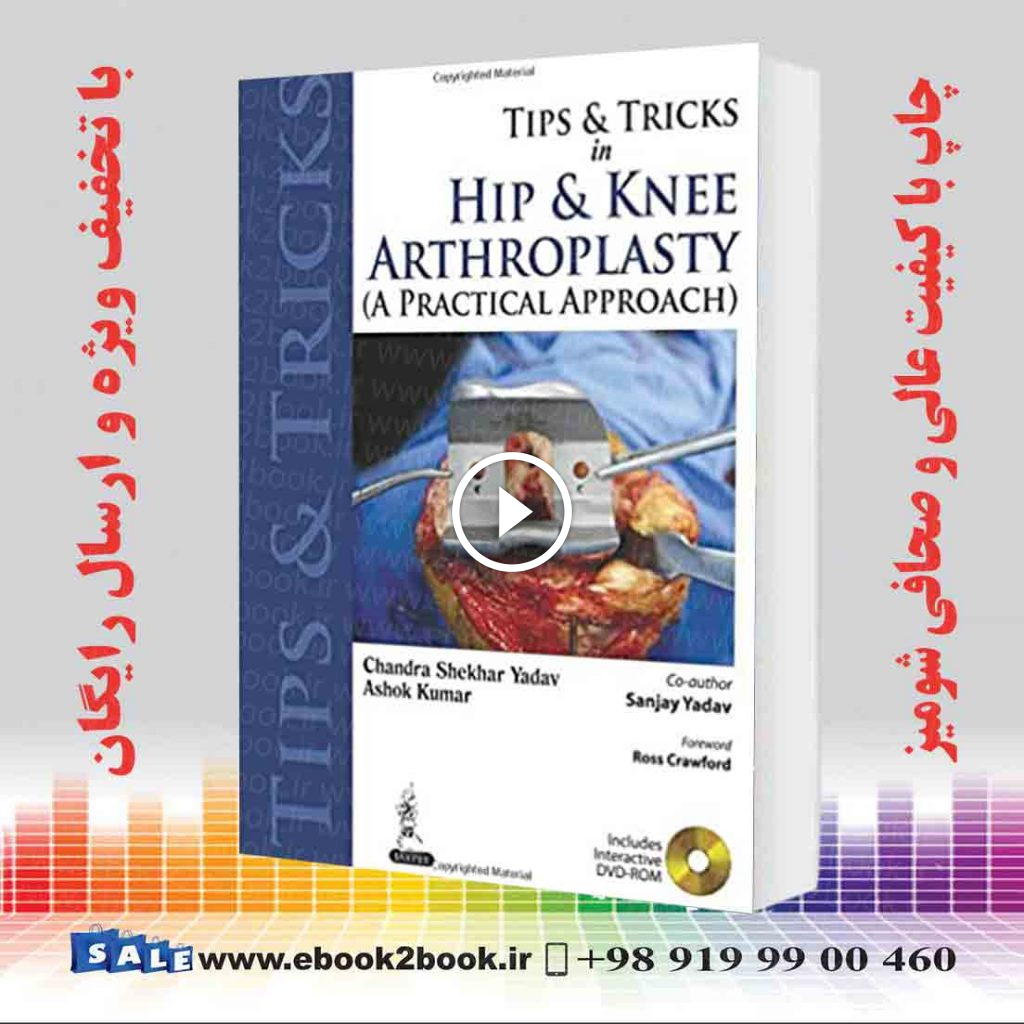 Tips and Tricks in Hip and Knee Arthroplasty