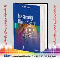 Mastering Rhinoplasty 2nd Edition