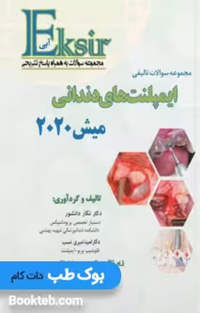 Eksir اکسیر آبی مجموعه سوالات تالیفی ایمپلنت های دندانی میش 2020