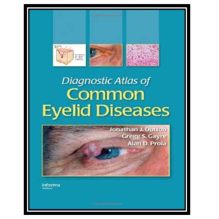 کتاب Diagnostic Atlas of Common Eyelid Diseases Informa Healthcare اثر جمعی از نویسندگان انتشارات مؤلفین طلایی