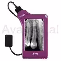 سنسور rvg مای ری My Ray مدل X-Pod سایز 1