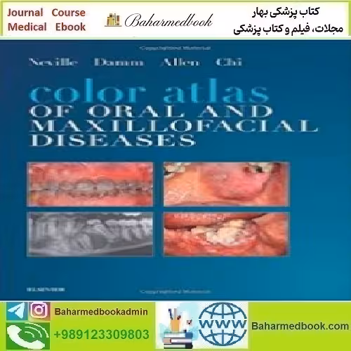 Color Atlas of Oral and Maxillofacial Diseases 2019