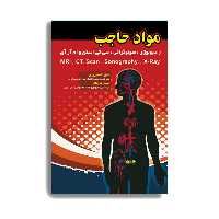 کتاب مواد حاجب. اثر دکتر فضل الله تورچیان انتشارات حیدری