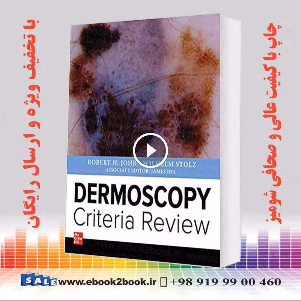 Dermoscopy Criteria Review