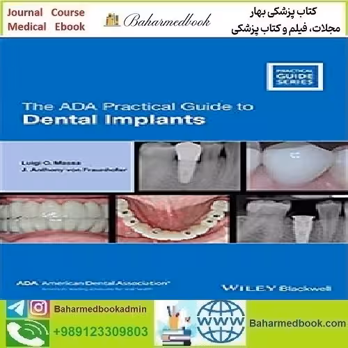 The ADA Practical Guide to Dental Implants 2021