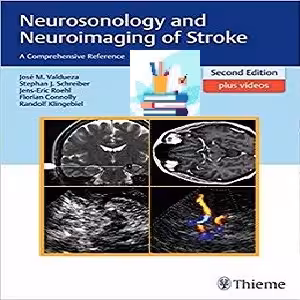 Neurosonology and Neuroimaging of Stroke 2ed PDF Video at 2€ - کتاب پزشکی بهار