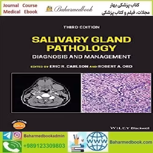 Salivary Gland Pathology Diagnosis and Management 2022