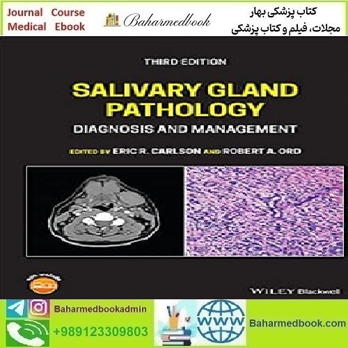 Salivary Gland Pathology Diagnosis and Management 2022