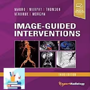 Image-Guided Interventions TRUE PDF price 1€