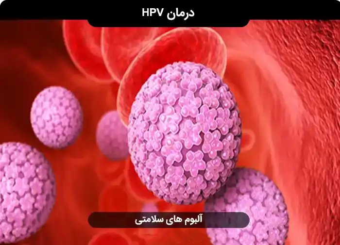 خرید و دانلود فایل پاکسازی ویروس hpv از بدن ( درمان اچ پی وی )