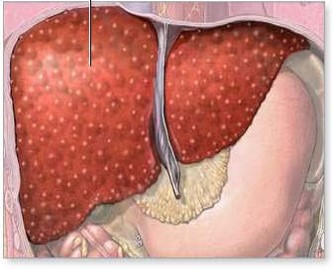 دانلود پاورپوینت بررسی کبد چرب