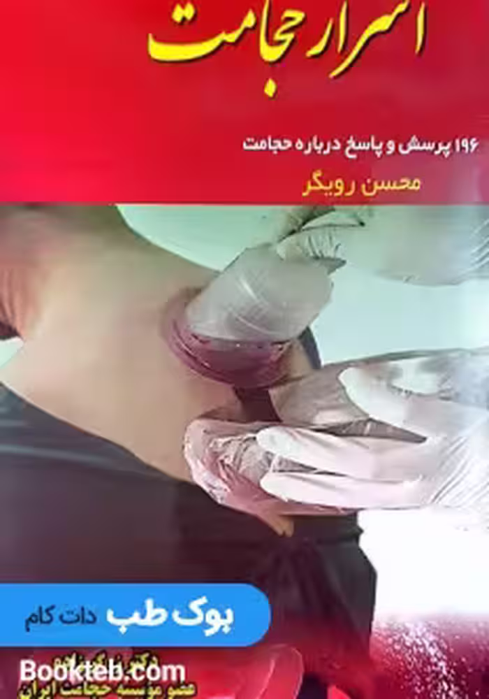 اسرار حجامت