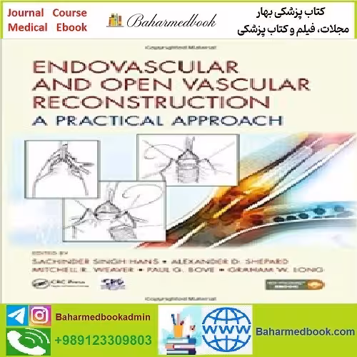 Endovascular and Open Vascular Reconstruction TRUE PDF pri